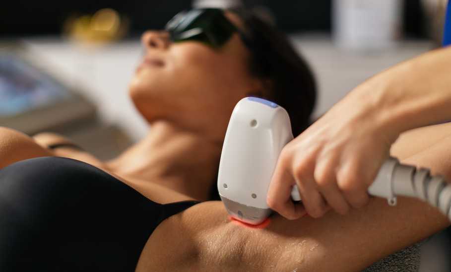 How Does Laser Hair Removal Work?